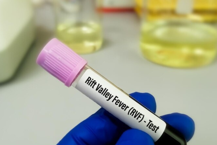 القلق يتصاعد في السنغال مع تسجيل 17 حالة وفاة بسبب حمى الوادي المتصدع القلق يتصاعد في السنغال مع تسجيل 17 حالة وفاة بسبب حمى الوادي المتصدع