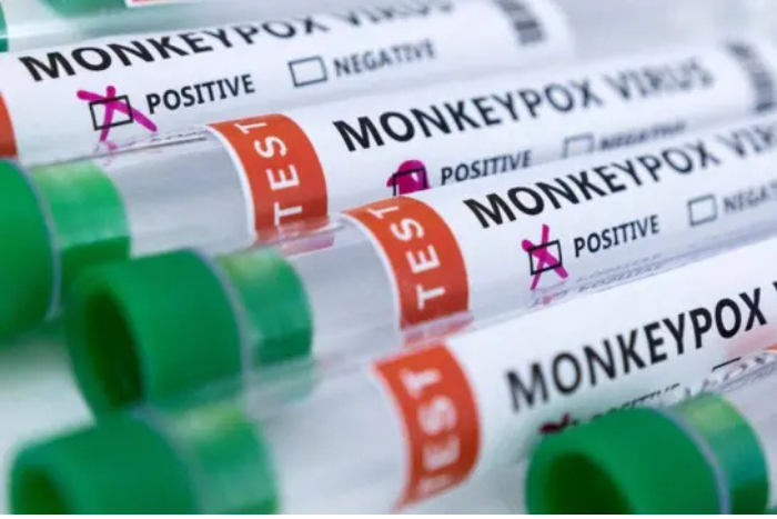   ثلث لقاحات جدري القردة في الكونغو الديمقراطية تهدر بسبب صعوبات التخزين والتوزيع