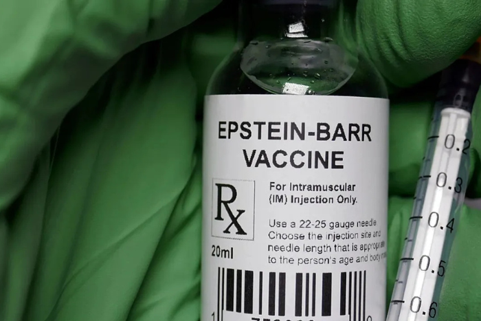 دراسة ستانفورد تكشف دور فيروس إبشتاين-بار كالمسبب الرئيسي لمرض الذئبة