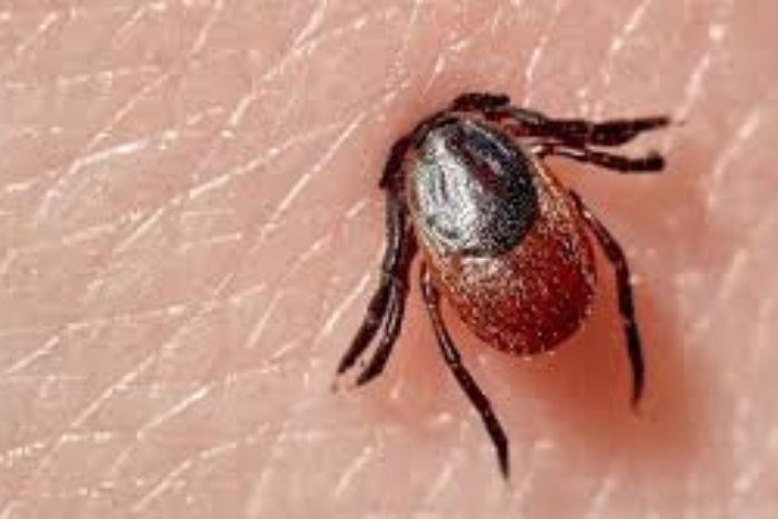 أول وفاة يرجح ارتباطها بمتلازمة ألفا غال في الولايات المتحدة حساسية تنشطها لدغات قراد لون ستار