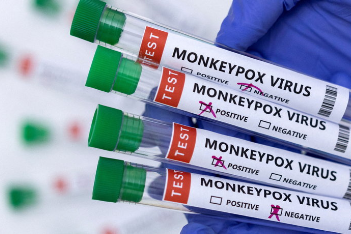 السنغال تسجل حالة إصابة ثانية بفيروس جدري القردة إمبوكس السنغال تسجل حالة إصابة ثانية بفيروس جدري القردة إمبوكس