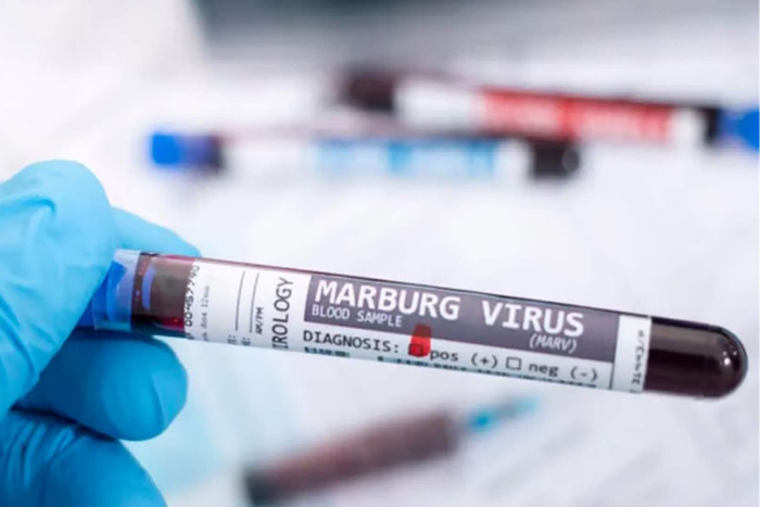 ارتفاع الوفيات بفيروس ماربورغ في إثيوبيا إلى 6 حالات
