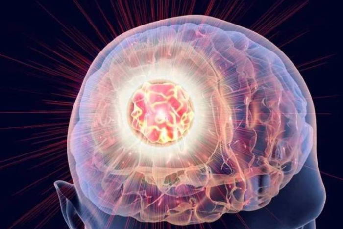 الهيستوتريپسي تقنية ثورية لتفتيت الأورام بالموجات الصوتية من دون جراحة