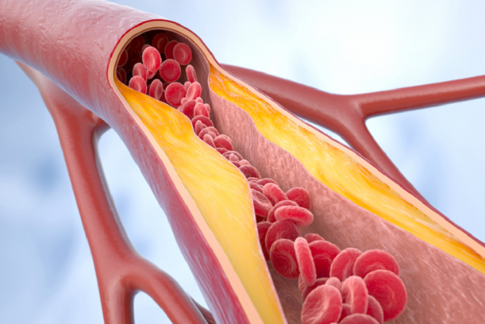 باحثون أمريكيون يكتشفون دور الدهون البيجية في ضبط ضغط الدم