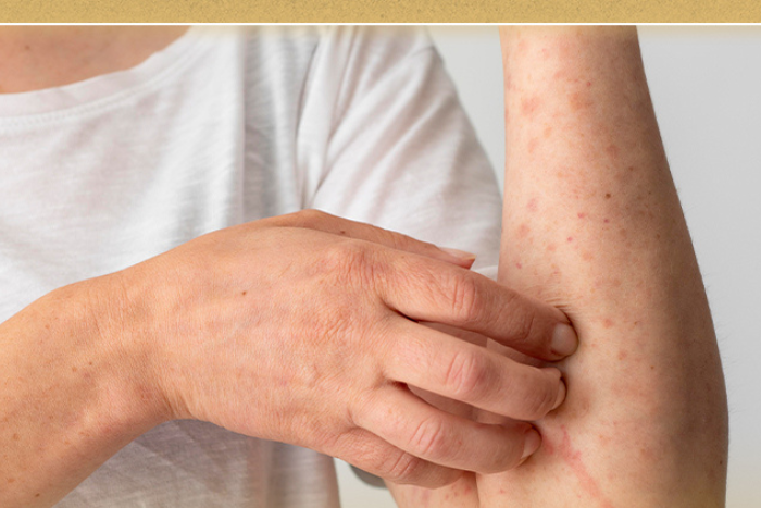 ابتكار سعودي يكشف الحساسية الغذائية قبل ظهور الأعراض