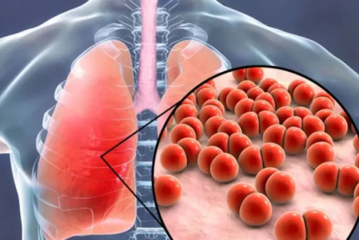 السل يواصل الانتشار في موزمبيق: أكثر من 125 ألف إصابة سنويًا رغم جهود المكافحة