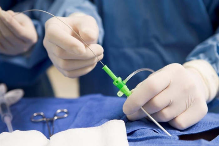 إنجاز طبي بارز بفاس: إجراء 450 عملية قسطرة قلبية في ظرف 18 شهرا