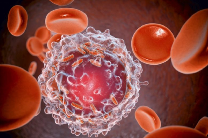 علاج تجريبي يظهر فعالية في علاج مرضى سرطان الدم